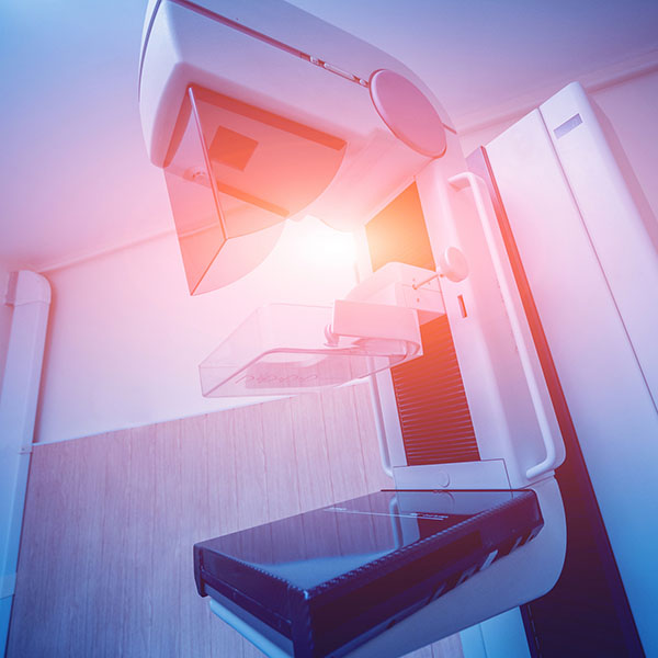 Mammography Imaging